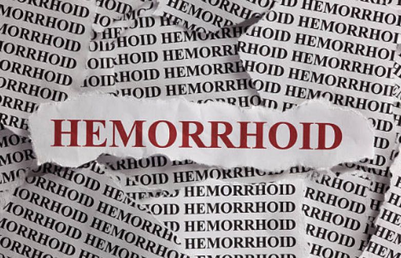 LE EMORROIDI